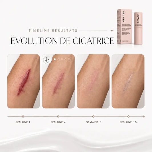 Évolution d'une cicatrice chirurgicale traitée au silicone médical semaine par semaine (1, 4, 8, 12) avec le stick EFFAZE
