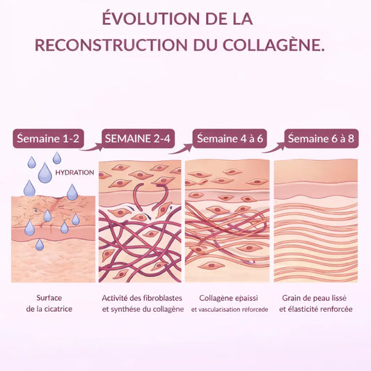 Schéma de l'évolution de la reconstruction du collagène sur plusieurs semaines avec EFFAZE