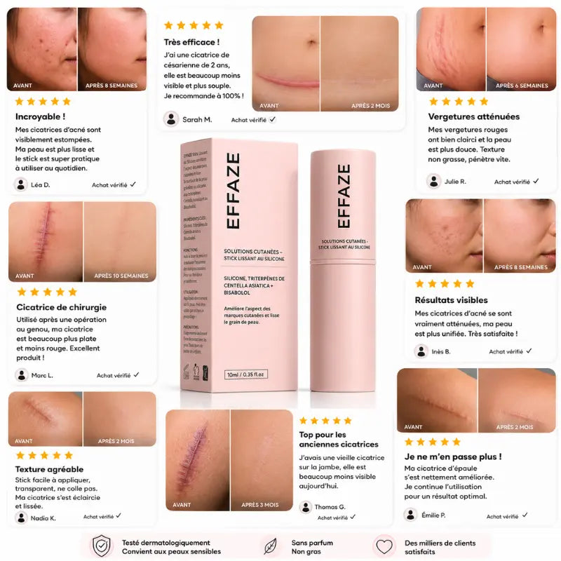 Avis vérifiés clients EFFAZE avant après cicatrices acné vergetures césarienne chirurgie résultats visibles silicone médical testé dermatologiquement