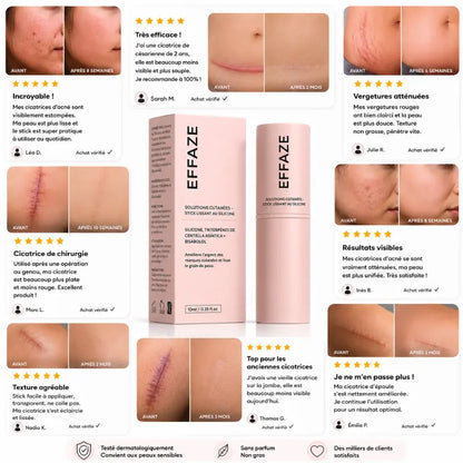 Avis vérifiés clients EFFAZE avant après cicatrices acné vergetures césarienne chirurgie résultats visibles silicone médical testé dermatologiquement