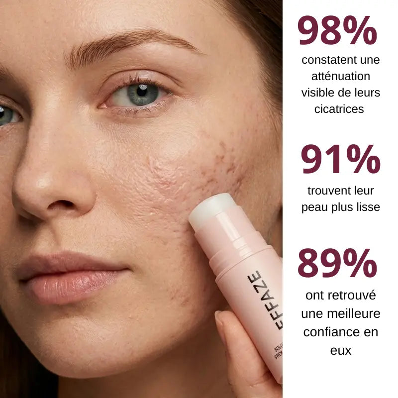 Résultats cliniques Effaze : 98% constatent une atténuation des cicatrices acné avec le stick silicone médical
