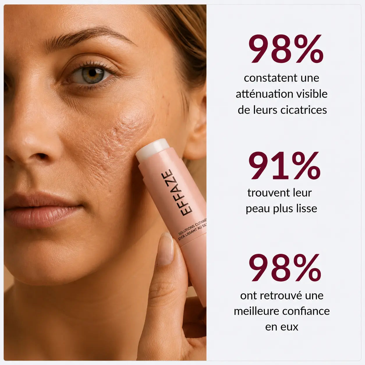 Resultats et pourcentages de satisfaction client du Stick Silicone Cicatrice Effaze