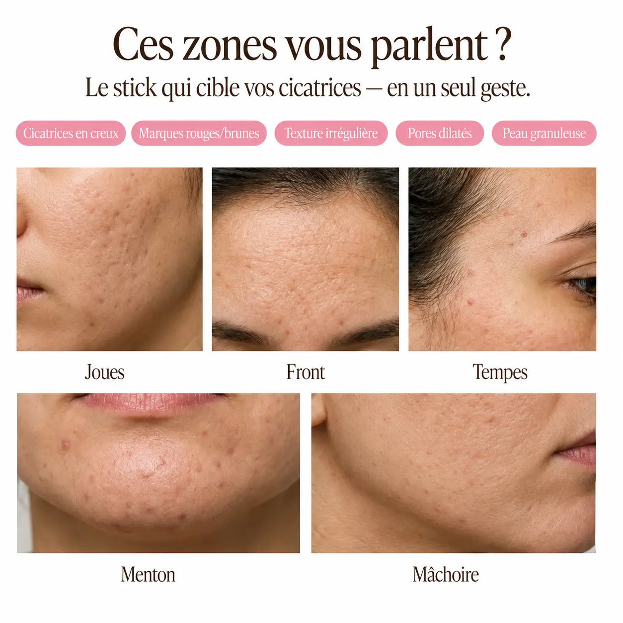 Zones du visage ciblées par le stick Effaze : joues, front, tempes, menton, mâchoire