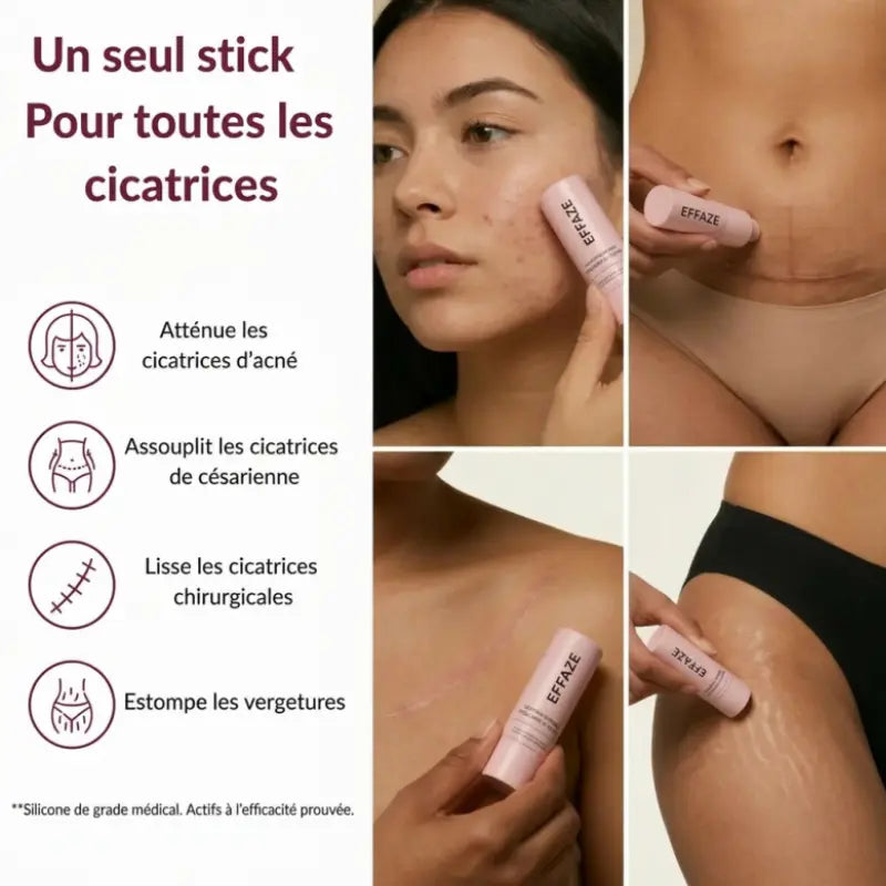 Stick silicone médical Effaze pour traiter cicatrices acné césarienne chirurgicales et vergetures